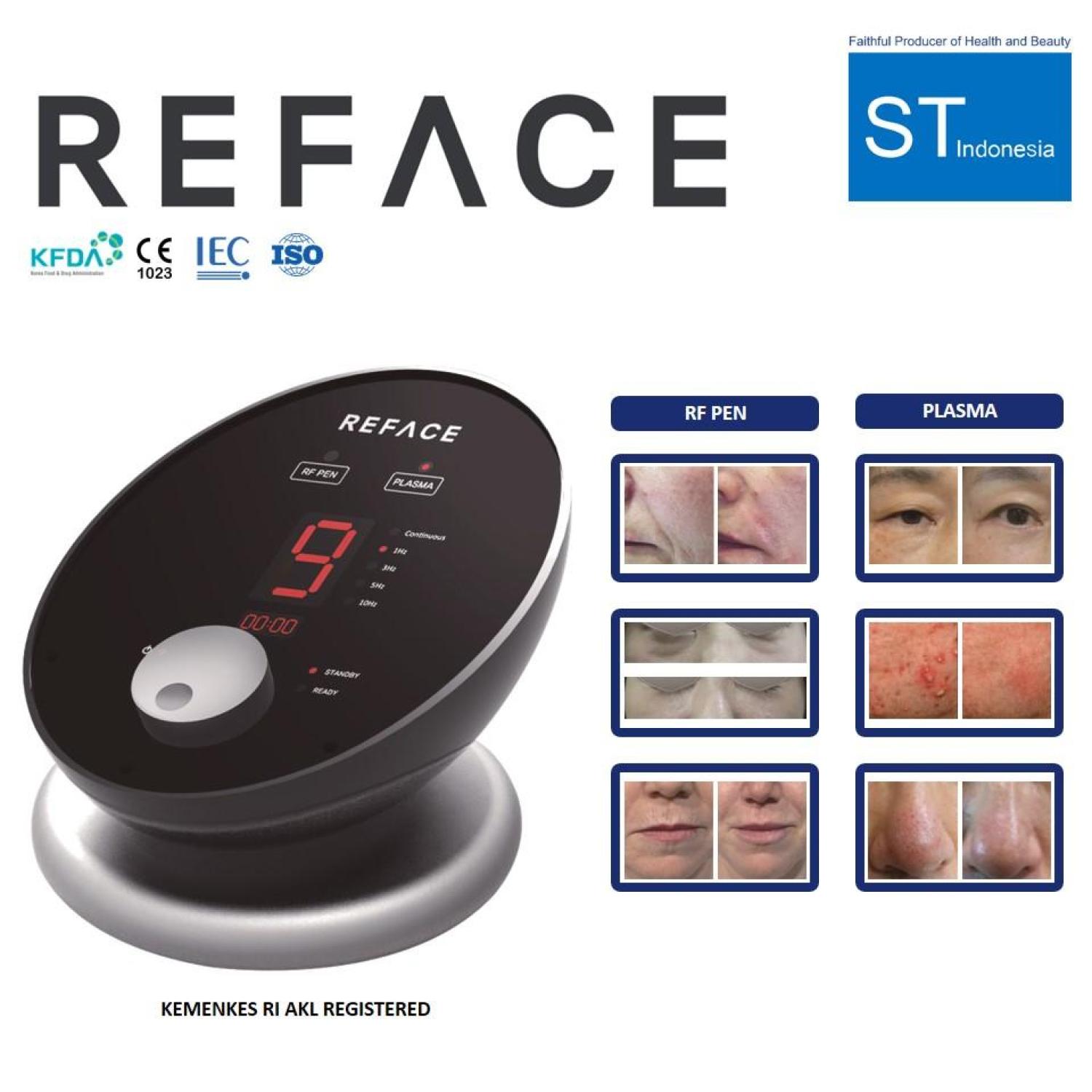 RF SUBCISION AND PLASMA TECHNOLOGY REFACE