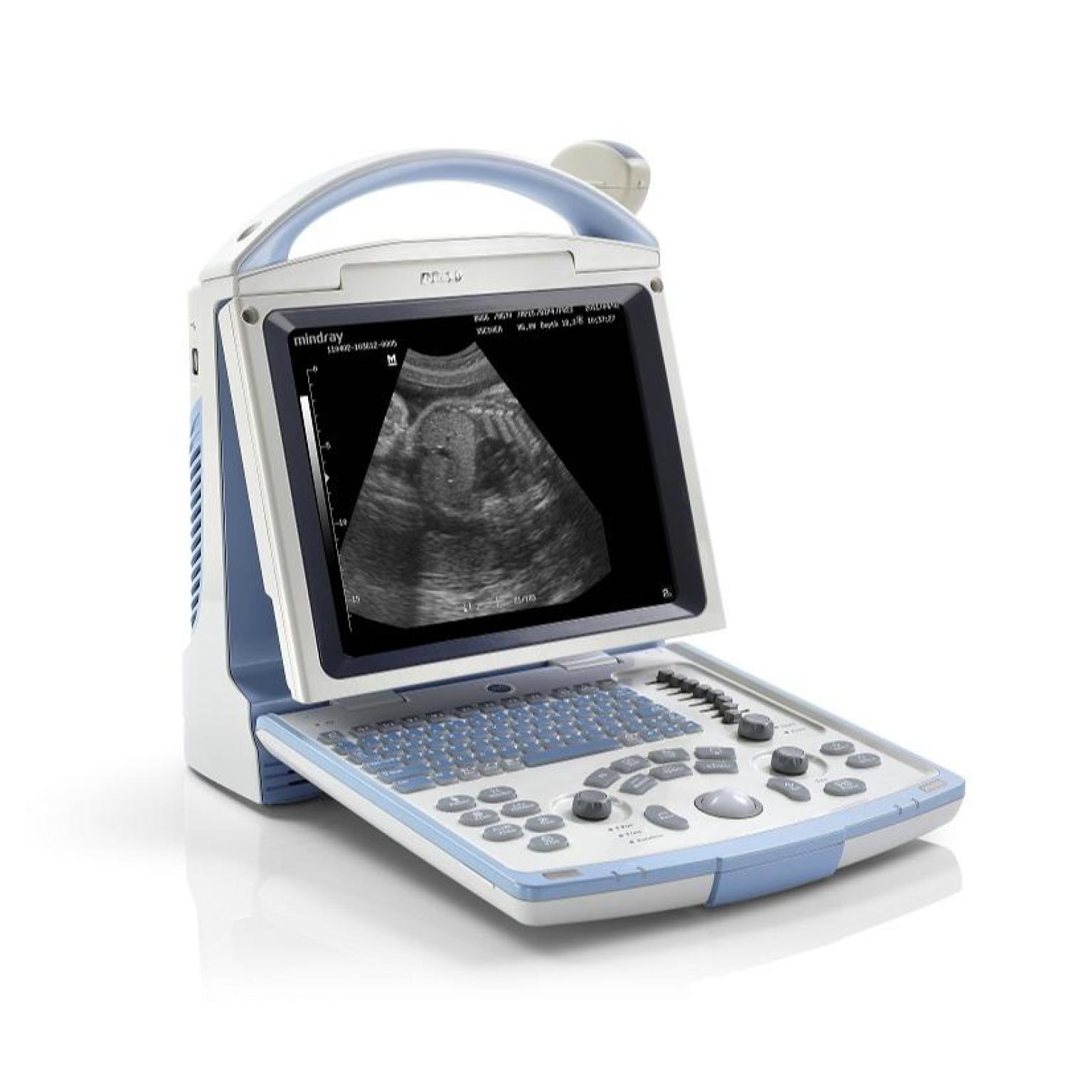Mindray DP10