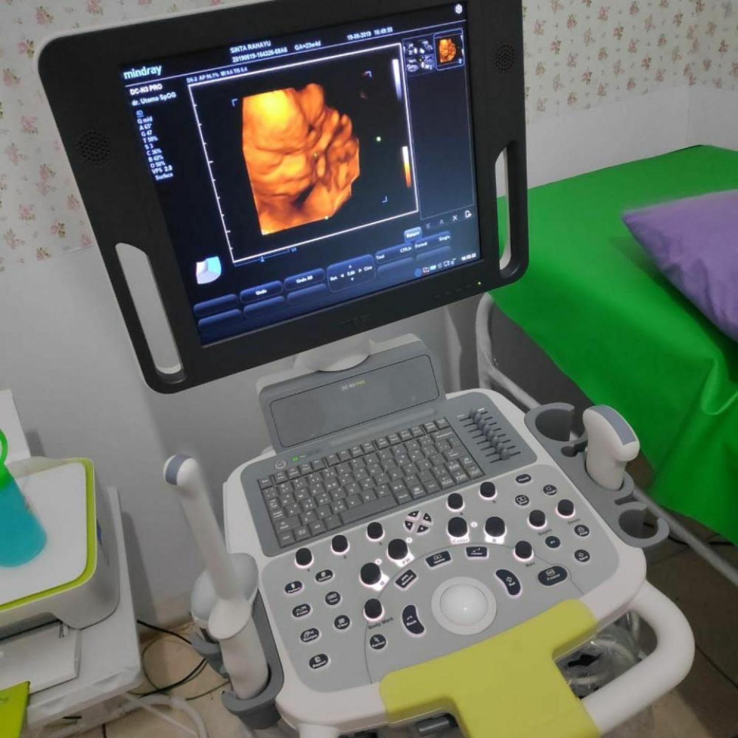 USG 4 D Mindray DCN3 Pro 