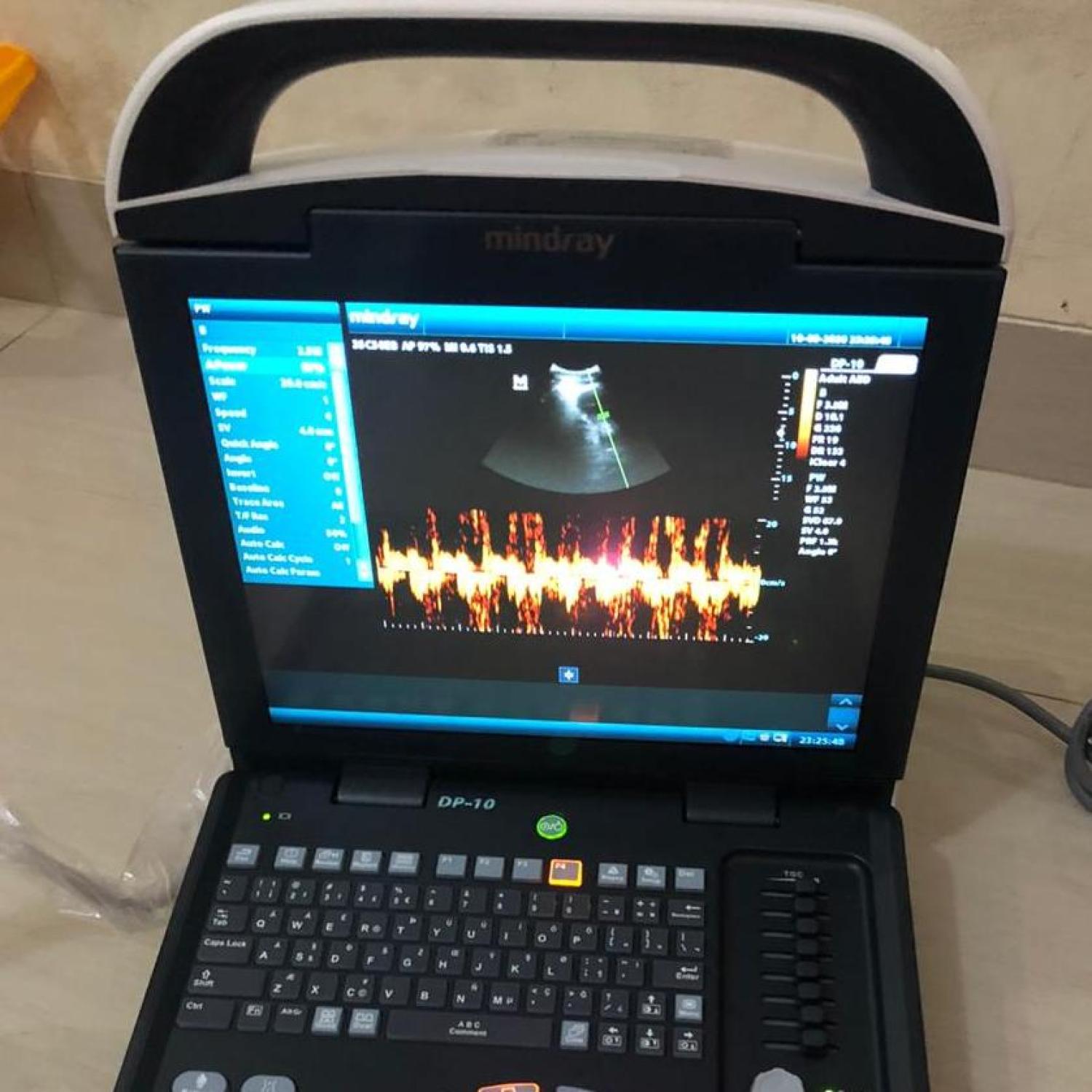 USG Mindray DP 10