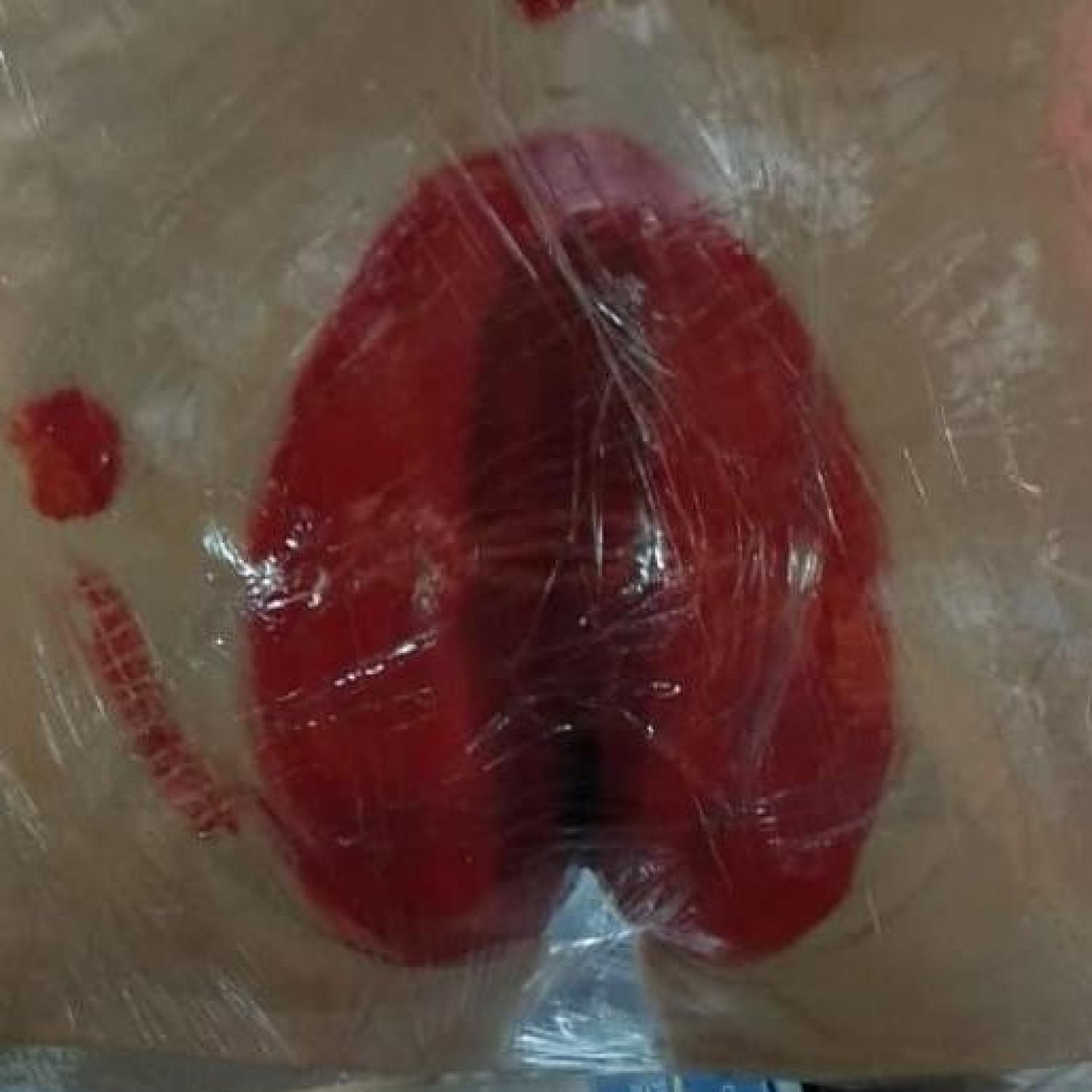 MANIKIN DECUBITUS / PHANTOM MANEKIN / MANIKIN BOKONG DECUBITUS